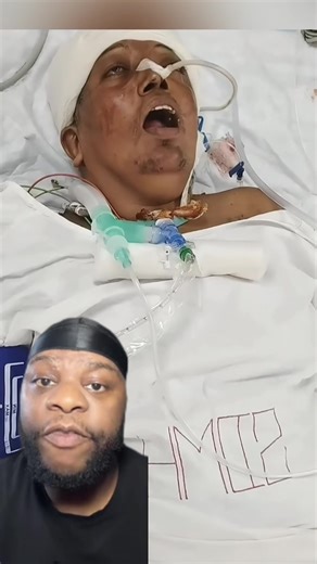 Legionnaires Disease Cluster: 3 Dead and 67 Sick in NYC