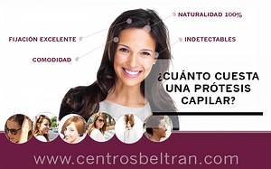 Precio de una prótesis capilar