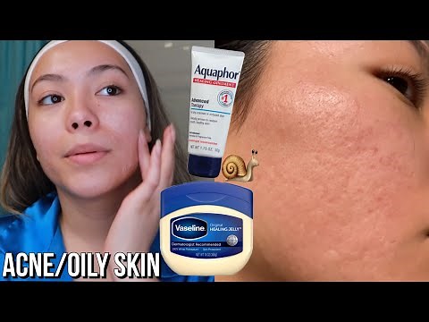 Viral Skincare: Slugging using Vaseline and Aquaphor!