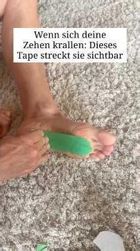 Tape Your Feet for Claw Toes!