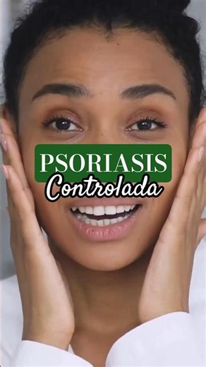 What I Do When My Psoriasis Is Under Control