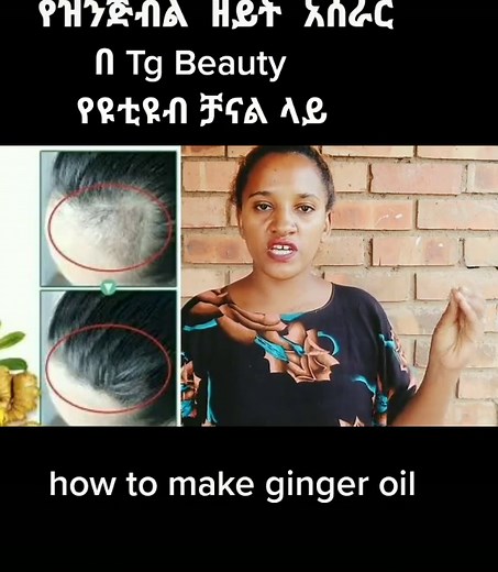 #gingeroilforhairgrowth #fypage #youtube