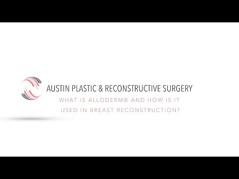 What is AlloDerm® and How is it Used in Breast Reconstruction?