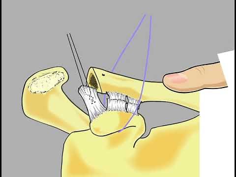 Open Weaver Dunn Animation 06