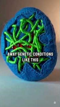 CRISPR Removes Extra Chromosome in Down Syndrome Cells