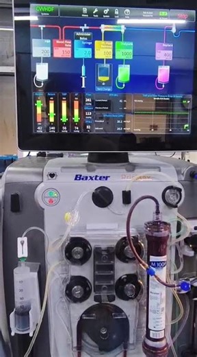 CRRT :- Continuous Renal Replacement Therapy #criticalcare #icunurse #eclampsia #hospital #life