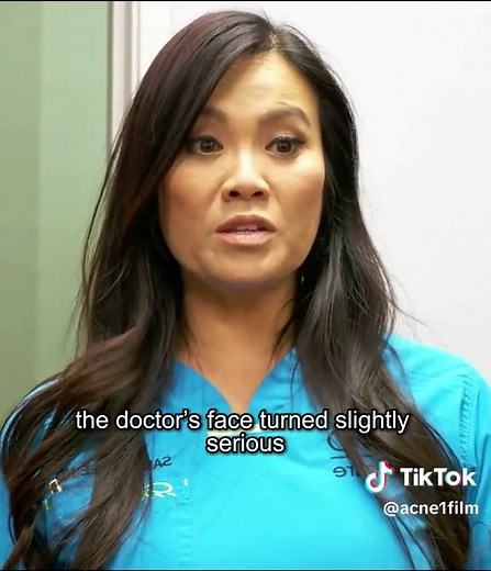 Cyst Removal by Dr. Pimple Popper