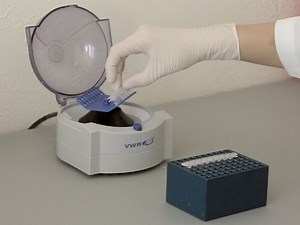 Development of a Quantitative Recombinase Polymerase Amplification Assay with an Internal Positive Control