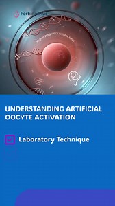Artificial Oocyte Activation (AOA) is a groundbreaking laboratory technique that enhances fertilization success rates in assisted reproductive technologies. 🧬 By using specific chemicals or electrical pulses, AOA simulates the natural signals required to activate an egg after sperm injection. This process is crucial for eggs that may not respond adequately on their own, ultimately leading to improved embryonic development. 🌱 Understanding AOA’s role in fertility treatments opens doors for coup