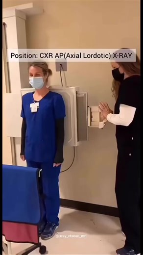 Chest Lordotic Positioning in Radiology Explained