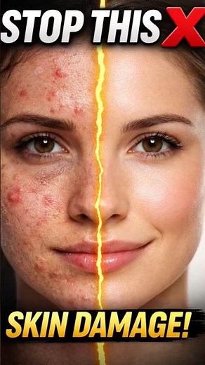 I Tried 10 DIY Acne Treatments