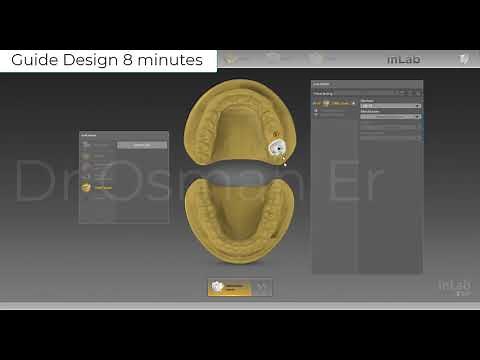 Digital Implant Planning with Galileos Implant SW and Guide Design with inLab19 SW