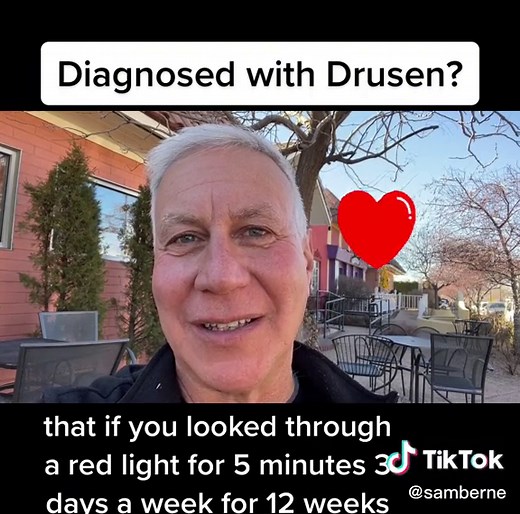 Understanding Drusen: Eye Exam Insights