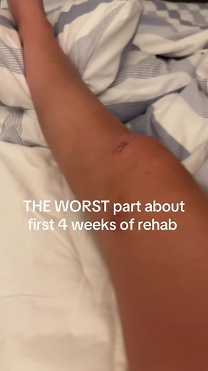 The pain of trying to straighten your leg is unmatched 😩 #aclsurgery #recovery #fyp #crutches