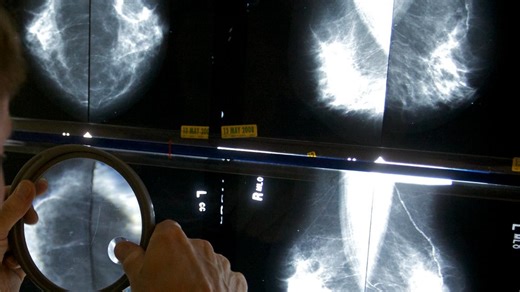 New cancer clinic to open in Des Moines