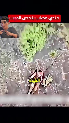 103K views · 546 reactions | جندي مصاب يتحدى الموت بنظرات قاتلة An injured soldier defies death with deadly looks. #Ukraine #Shorts #أوكرانيا #نهاية_العالم #russia #العالم #short #روسيا #سياسة #معلومات #shortsreels #حرب_نووية #news #army #military #العالم | مصطفى عدلي | Facebook