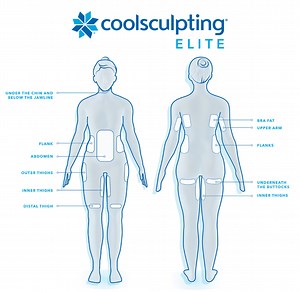 Coolsculpting Elite in Wilmington, NC | Near Me | Wrightsville Beach