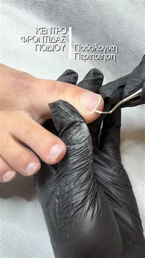 Κέντρο Φροντίδας Ποδιού on Instagram: "ΘΕΡΑΠΕΥΤΙΚΟ ΠΕΝΤΙΚΙΟΥΡ 🦶ΜΕΡΟΣ ΠΡΩΤΟ🦶 Το θεραπευτικό πεντικιούρ διαφέρει από το αισθητικό. Δεν είναι απλώς μια περιποίηση ομορφιάς αλλά μια ουσιαστική φροντίδα για την υγεία των ποδιών. Προλαμβάνει, θεραπεύει, ανακουφίζει από προβλήματα των άκρων που δυσκολεύουν την καθημερινότητά σας. Κλείστε κι εσείς την δική σας ποδολογική φροντίδα στο Κέντρο Φροντίδας Ποδιού! #podology #διαβητικο_ποδι #κεντρο_φροντιδας_ποδιων #θεραπευτικόπεντικιούρ #ποδολόγος"