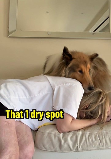 Managing Dry Skin: Tips for Recovery from Burns