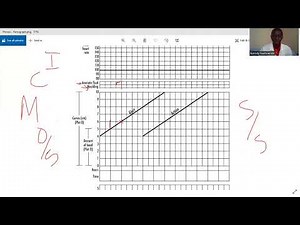 Partograph