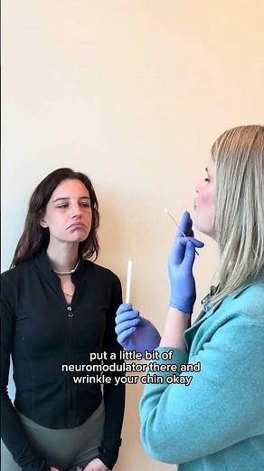 Lower Face Botox