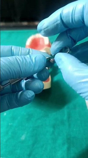 how to use dental tofflemire #dentalprosthesis#dentist #dentalartistry #dentalstudent #orthodontist