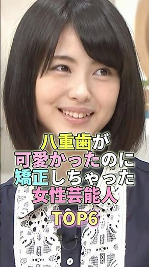 Top 6 female celebrities who had cute double teeth but ended up getting braces #MinamiHamabe #cel...