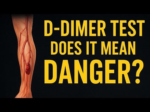 What is D-Dimer test | Why Doctor recommend it to you? | #shakirinsight