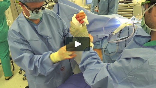 OTA Video Library - Extensile Fasciotomy for Compartment Syndrome of the Forearm and Hand