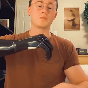 5.3M views · 5.1K reactions | This guy shows us what life is really like living with a bionic hand  | UNILAD Tech | Facebook