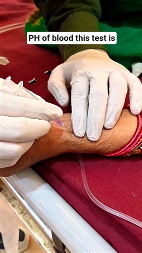 ABG Test Report #usa #reels #youtubeshorts #viral #trending #trendingshorts #nursing #ytshorts