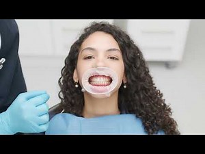 OptraGate 2 - Pacientes relajados y tratamientos eficaces | ES | Ivoclar