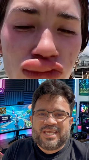 ALERGIAS MAIS BIZARRAS DO MUNDO 🤯