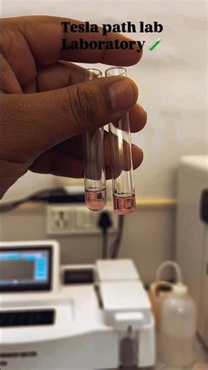 Laboratory life 🥼 #medical #hospital #pathology #lab #public #laboratory
