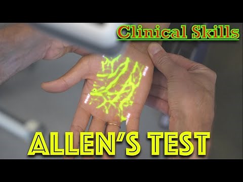 Allen's test for Blood Flow - Hand Examination - Dr Gill