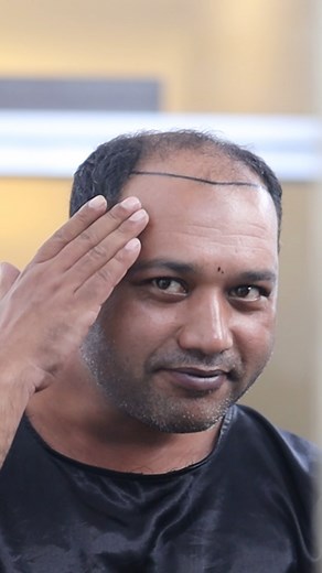 275K views · 3.8K reactions | আমি আমার টাকের স্থায়ী সমাধান খুঁজে...