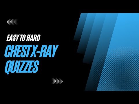Chest X-ray Quizzes: Easy to Hard