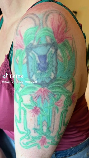 Swift_tattoo_removal on TikTok