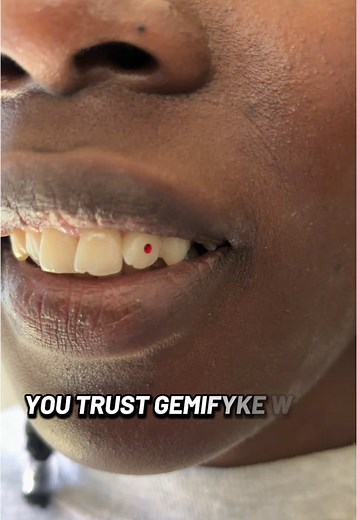 Ruby red for the beautiful Lucia❤️##@🦋👑 lugari icon ##eldorettiktokers #eldoret #toothgems #toothgems💎 #toothgemke #toothgemseldoret #hiddengems #gemifyke #gems