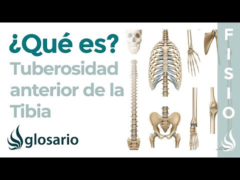 TUBEROSIDAD TIBIAL| Qué es, ubicación, qué se inserta en esta estructura y qué produce dolor