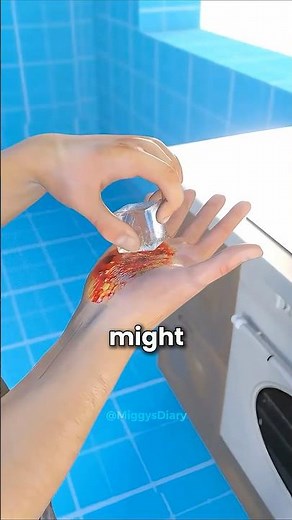 Burned yourself? Do THIS!