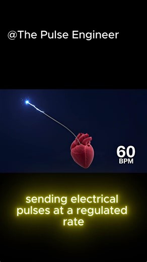How This Tiny Device Keeps You Alive! ⚡️ #Biomedical#Shorts#Pacemaker
