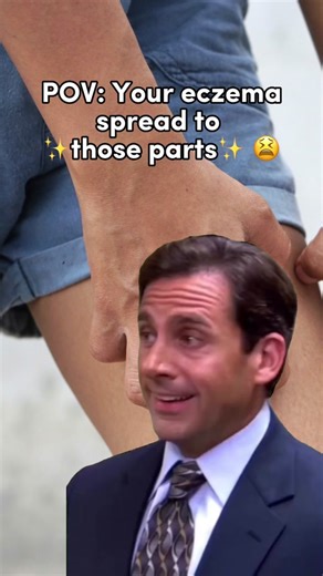 Understanding Genital Eczema: Symptoms, Causes, and Treatment