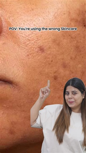 Alisha Chadha on Instagram: "7 days of consistency and my skin is visibly glowing✨ Loving AXIS-Y TXA 2.5% Intensive Brightening Cream. If you want real brightening without irritation, trust this one from @axisy_official #axisy #txacream #peaceofglow #darkspots #brightening"