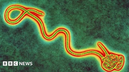 Why Ebola is so dangerous