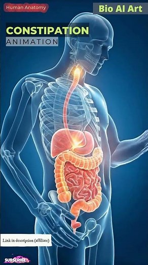 Fecal Impaction Blocks Colon Lumen Animation | Digestive System | Human Anatomy | Bio AI Art | 15