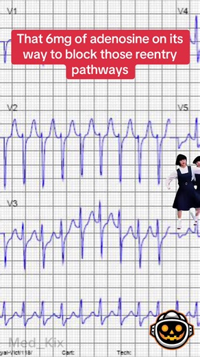 Understanding Adenosine in Cardiac Care