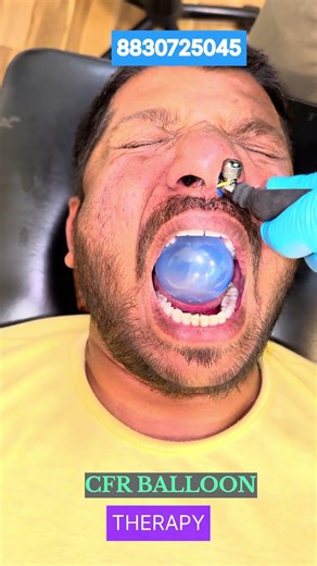 CFR for Facial Pain #chiropractor #cor #reelsvideo #reelsviral #migraine #viralstrending#Nashik#pune