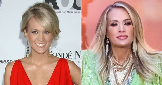 Carrie Underwood's Face Looks 'Different': Did She Get Fillers?