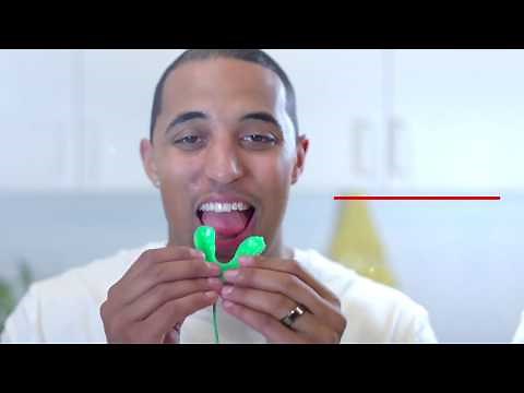 MOUTHGUARD FITTING INSTRUCTIONS
